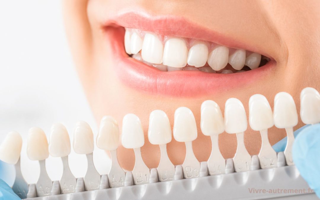 Ce secret du dentiste pour des dents plus blanches