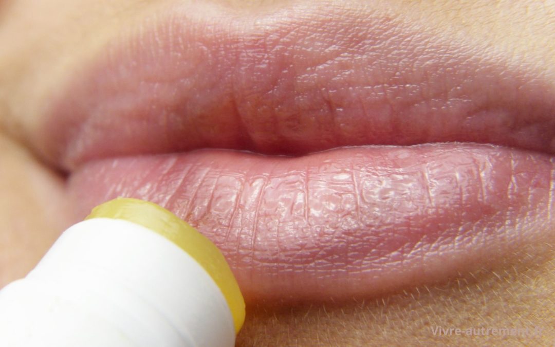 L&rsquo;astuce des dermatologues pour dire adieu aux lèvres gercées